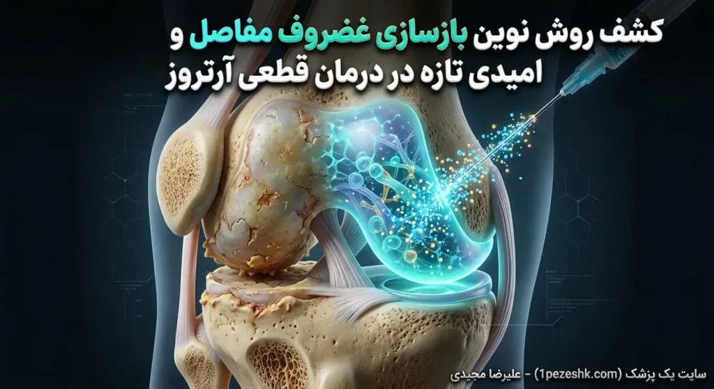 کشف روش نوین بازسازی غضروف مفاصل و امیدی تازه در درمان قطعی آرتروز