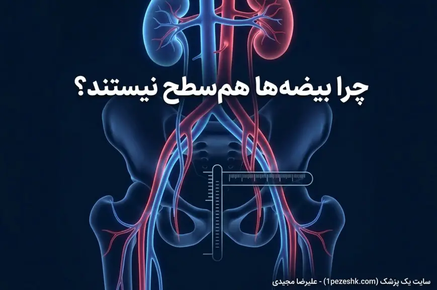 چرا بیضه چپ پایین‌تر است؟ علت نامتقارن بودن بیضه‌ها در مردان