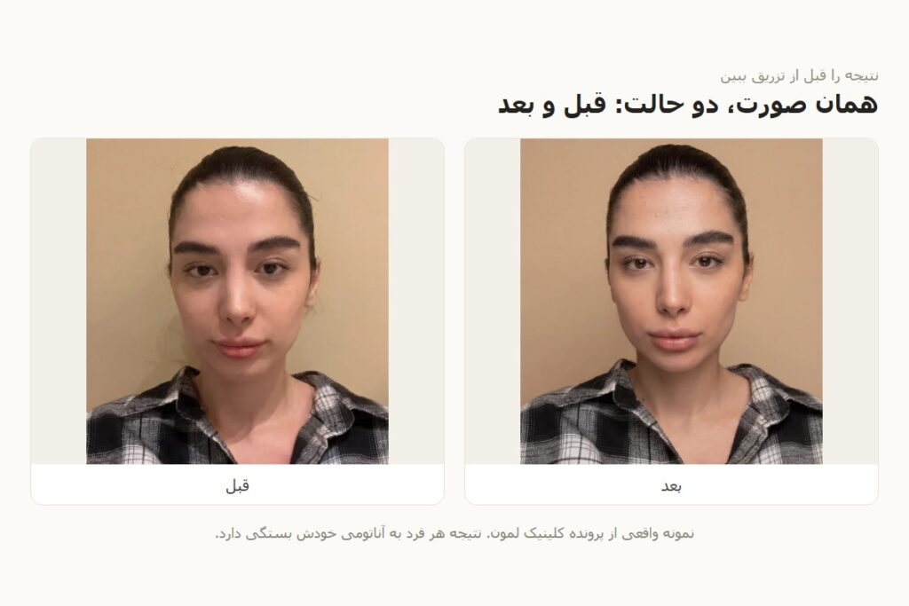 قبل از تزریق، نتیجه را ببینیم؟ کاری که هوش مصنوعی در مشاوره زیبایی می‌تواند بکند و کاری که نمی‌تواند