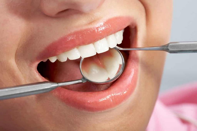 مواد غذایی شگفت انگیز برای پیشگیری از پوسیدگی دندان