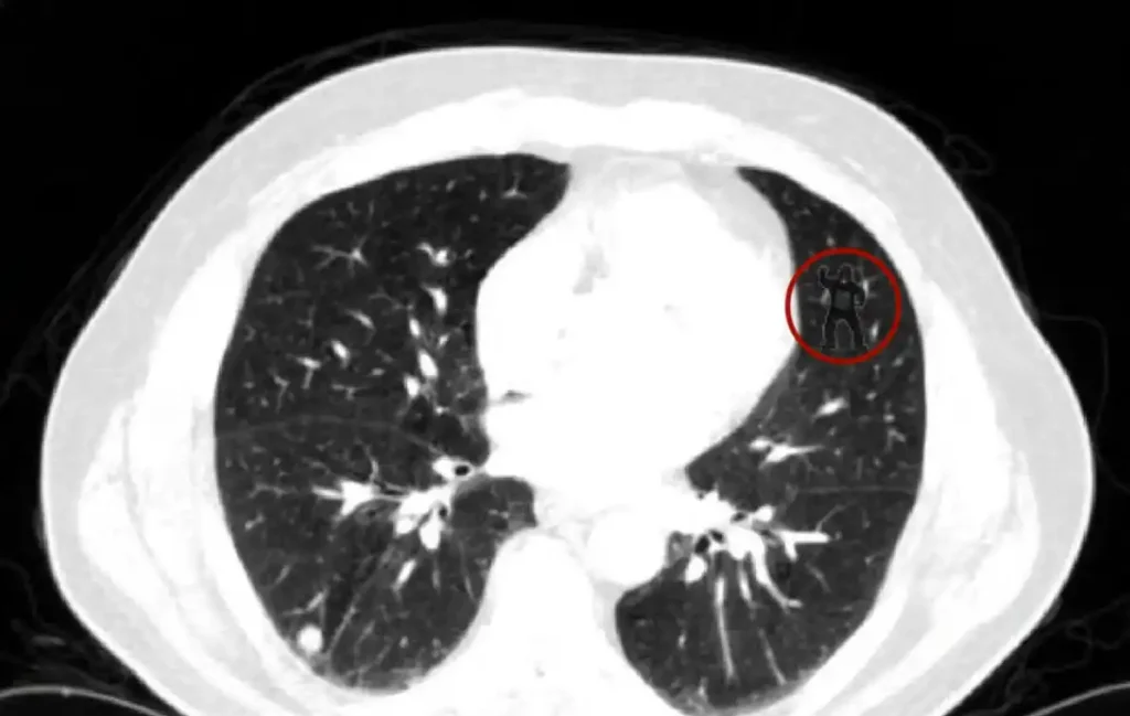 از گوریل رادیولوژی تا کوری شناختی جامعه؛ چرا حقایق روشن در جامعه دیده نمی‌شوند؟